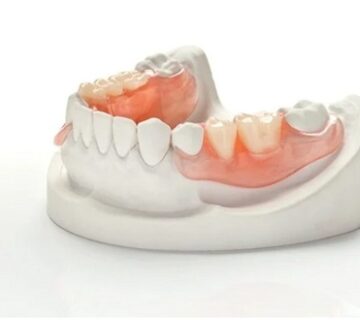 طقم الاسنان المتحرك