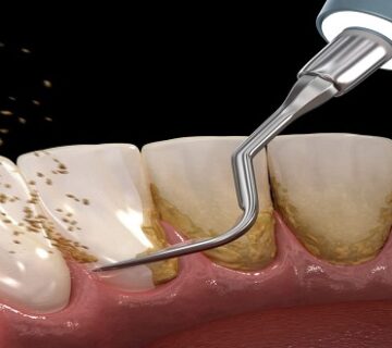 جهاز البروفي جت