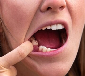 افضل دكتور خلع ضرس العقل في جدة