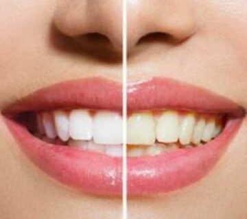 افضل عيادة تنظيف اسنان في جدة